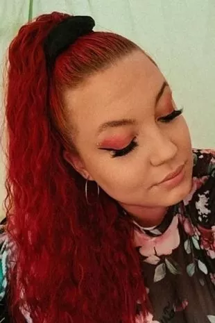 一名女子一直认为腹胀是正常的,直到她从摩托车上摔下来