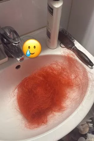 一名女子一直认为腹胀是正常的,直到她从摩托车上摔下来