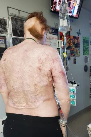 “我在街上被陌生人活活烧死,但活了下来,看到正义得到伸张”