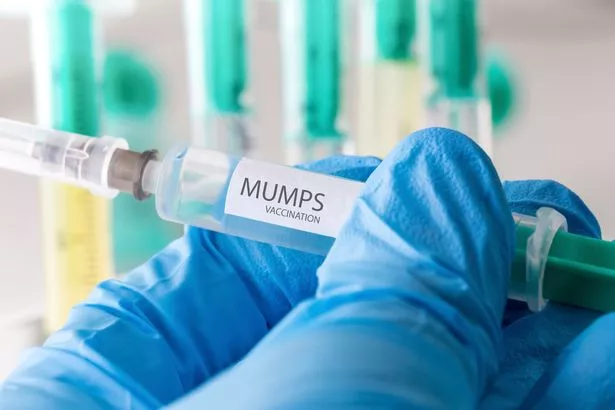 由于担心流行性腮腺炎,英国卫生部门负责人发布了令人不寒而栗的冬季警告